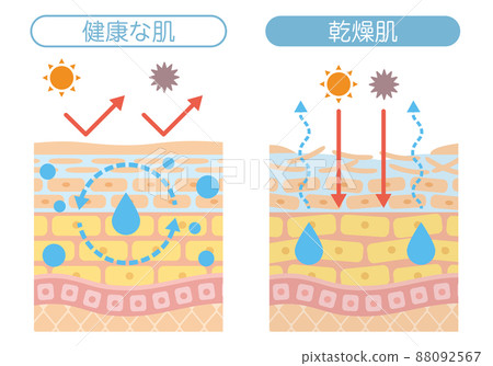 皮膚結構_乾性皮膚 88092567