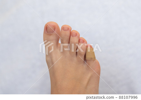 Medical plaster on the female little toe. Wound at toe healed with a band aid for medical care Medical plaster on the female little toe. Wound at toe healed with a band aid for medical care 88107996