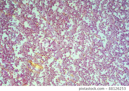 人體血液顯微鏡圖像 88126253