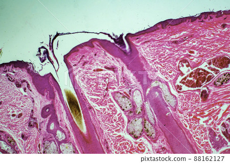 Human epidermal root hair microscopic image 88162127