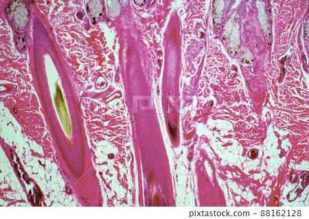 Human epidermal root hair microscopic image 88162128