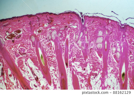 Human epidermal root hair microscopic image Human epidermal root hair microscopic image 88162129