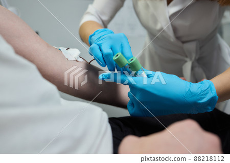 Beautician doctor's hands put test tube with blood in centrifuge container. Rejuvenation plasmolifting procedure. Beautician doctor's hands put test tube with blood in centrifuge container. Rejuvenation plasmolifting procedure. 88218112