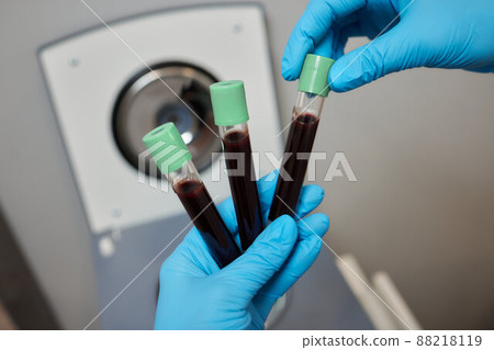Beautician doctor's hands put test tube with blood in centrifuge container. Rejuvenation plasmolifting procedure. Beautician doctor's hands put test tube with blood in centrifuge container. Rejuvenation plasmolifting procedure. 88218119