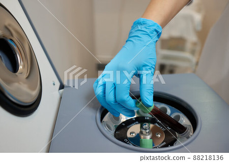 Beautician doctor's hands put test tube with blood in centrifuge container. Rejuvenation plasmolifting procedure. Beautician doctor's hands put test tube with blood in centrifuge container. Rejuvenation plasmolifting procedure. 88218136