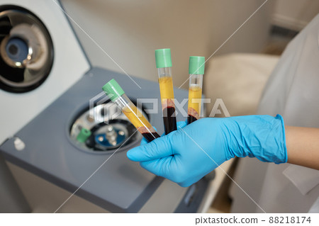 Beautician doctor's hands put test tube with blood in centrifuge container. Rejuvenation plasmolifting procedure. 88218174