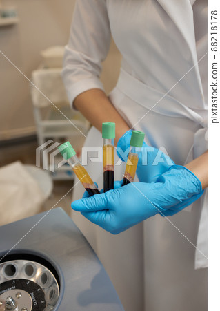 Beautician doctor's hands put test tube with blood in centrifuge container. Rejuvenation plasmolifting procedure. Beautician doctor's hands put test tube with blood in centrifuge container. Rejuvenation plasmolifting procedure. 88218178
