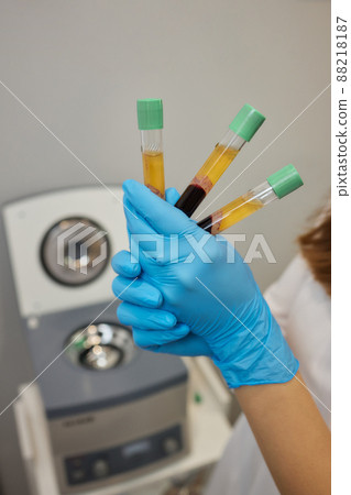 Beautician doctor's hands put test tube with blood in centrifuge container. Rejuvenation plasmolifting procedure. 88218187
