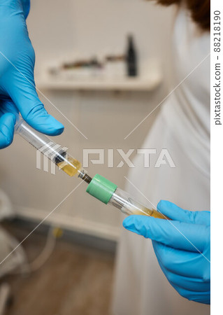 Beautician doctor's hands put test tube with blood in centrifuge container. Rejuvenation plasmolifting procedure. Beautician doctor's hands put test tube with blood in centrifuge container. Rejuvenation plasmolifting procedure. 88218190