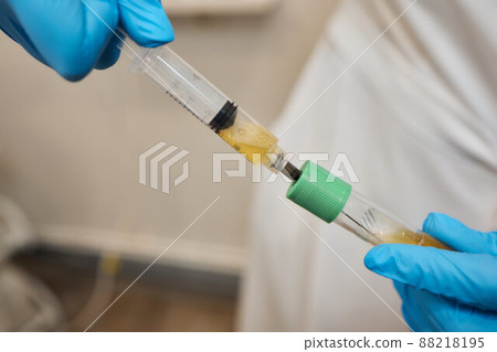 Beautician doctor's hands put test tube with blood in centrifuge container. Rejuvenation plasmolifting procedure. Beautician doctor's hands put test tube with blood in centrifuge container. Rejuvenation plasmolifting procedure. 88218195