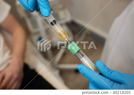 Beautician doctor's hands put test tube with blood in centrifuge container. Rejuvenation plasmolifting procedure. Beautician doctor's hands put test tube with blood in centrifuge container. Rejuvenation plasmolifting procedure. 88218205