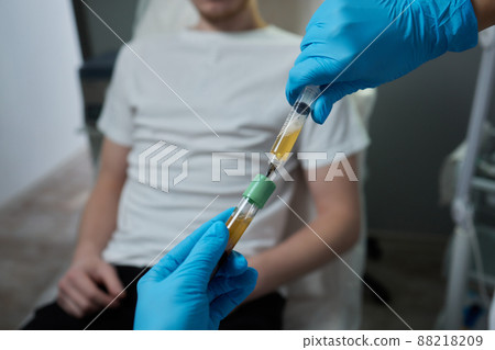 Beautician doctor's hands put test tube with blood in centrifuge container. Rejuvenation plasmolifting procedure. Beautician doctor's hands put test tube with blood in centrifuge container. Rejuvenation plasmolifting procedure. 88218209