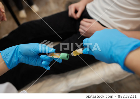 Beautician doctor's hands put test tube with blood in centrifuge container. Rejuvenation plasmolifting procedure. Beautician doctor's hands put test tube with blood in centrifuge container. Rejuvenation plasmolifting procedure. 88218211