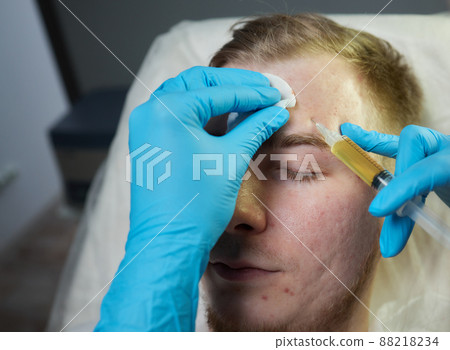 Injection at spa salon. Doctor hands in gloves. Closeup. Pretty male patient. Beauty treatment. Healthy skin procedure. Young man face. Plasmolifting rejuvenation. Injection at spa salon. Doctor hands in gloves. Closeup. Pretty male patient. Beauty treatment. Healthy skin procedure. Young man face. Plasmolifting rejuvenation. 88218234
