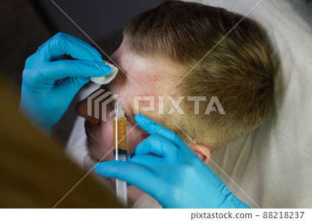 Injection at spa salon. Doctor hands in gloves. Closeup. Pretty male patient. Beauty treatment. Healthy skin procedure. Young man face. Plasmolifting rejuvenation. 88218237