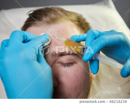 Injection at spa salon. Doctor hands in gloves. Closeup. Pretty male patient. Beauty treatment. Healthy skin procedure. Young man face. Plasmolifting rejuvenation. Injection at spa salon. Doctor hands in gloves. Closeup. Pretty male patient. Beauty treatment. Healthy skin procedure. Young man face. Plasmolifting rejuvenation. 88218238