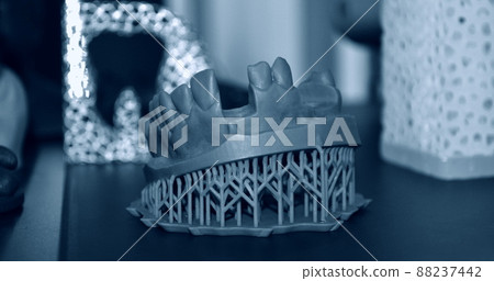Human lower jaw printed on 3d printer of photopolymer 88237442