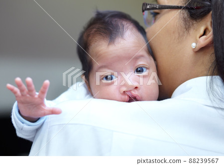 She is safe in her mothers arms. Portrait of a baby girl who has a cleft palate looking over the shoulder of her mother. She is safe in her mothers arms. Portrait of a baby girl who has a cleft palate looking over the shoulder of her mother. 88239567