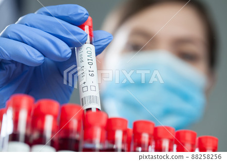 Doctor pulling out a test tube with Coronavirus patient blood sample ready for laboratory examination 88258256