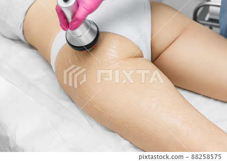 The doctor does the Rf lifting procedure on the legs, buttocks and hips of a woman in a beauty parlor. 88258575