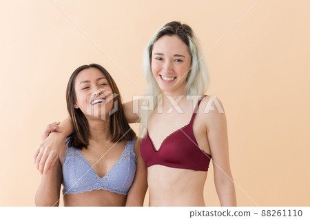 body inclusivity multiethnic unretouched scleroderma young Latin, Hispanic woman. Body positivity 88261110