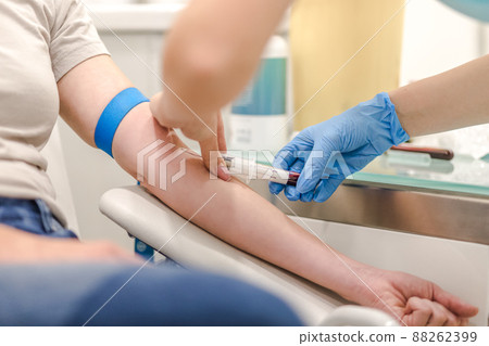 Close-up Of Doctor Taking Blood Sample From Patient's Arm in Hospital for Medical Testing. 88262399