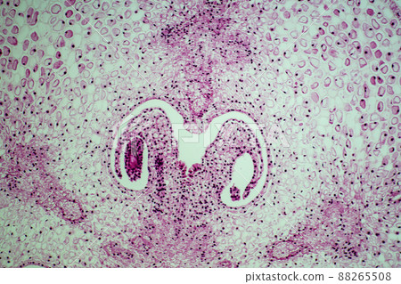 Cross section of lily ovary microscopic image 88265508