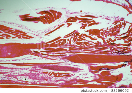 Tight connective tissue microscopic image Tight connective tissue microscopic image 88266092