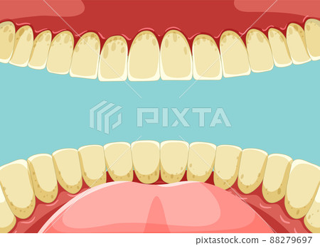 Human teeth inside mouth with yellow teeth 88279697