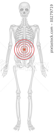 Skeleton lower back suffering from ankylosing spondylitis Skeleton lower back suffering from ankylosing spondylitis 88279719