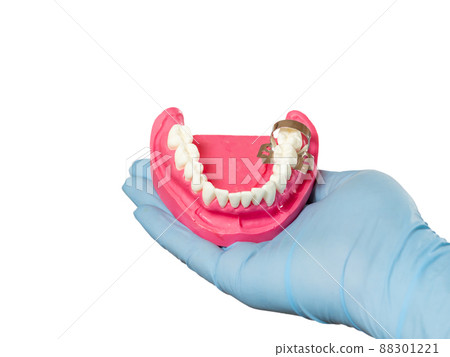 Dentist holding layout of the human jaw 88301221