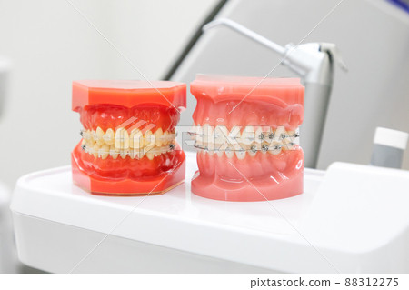 牙科診所正畸器具的正畸模型 88312275
