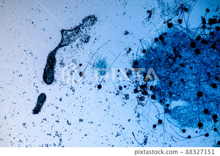 Aspergillus niger and Aspergillus oryzae  (mold) under microscope for Microbiology in Lab. 88327151