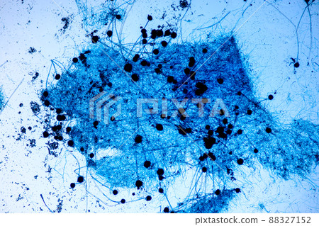 Aspergillus niger and Aspergillus oryzae  (mold) under microscope for Microbiology in Lab. 88327152
