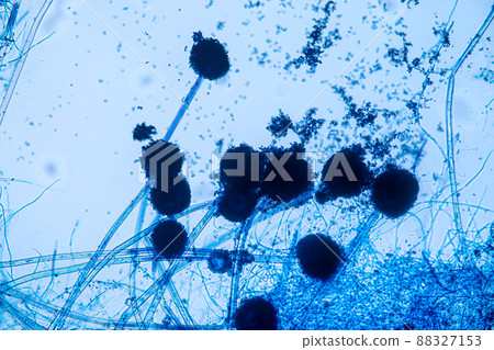 Aspergillus niger and Aspergillus oryzae  (mold) under microscope for Microbiology in Lab. 88327153