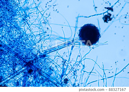 Aspergillus niger and Aspergillus oryzae  (mold) under microscope for Microbiology in Lab. 88327167
