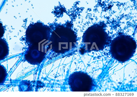 Aspergillus niger and Aspergillus oryzae  (mold) under microscope for Microbiology in Lab. 88327169