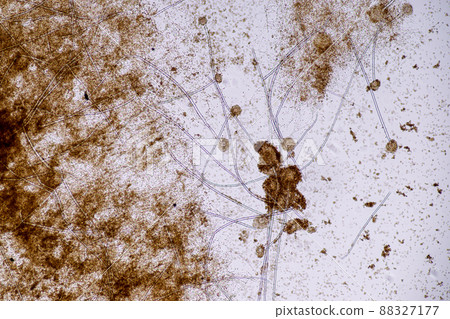 Aspergillus niger and Aspergillus oryzae (mold) under microscope for Microbiology in Lab. Aspergillus niger and Aspergillus oryzae (mold) under microscope for Microbiology in Lab. 88327177