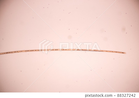 Characteristics of Hair cell of human under microscope view for education in laboratory. Characteristics of Hair cell of human under microscope view for education in laboratory. 88327242