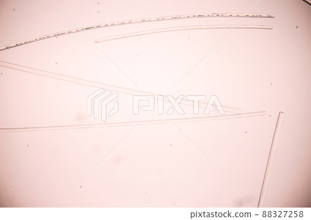 Characteristics of Hair cell of human under microscope view for education in laboratory. Characteristics of Hair cell of human under microscope view for education in laboratory. 88327258