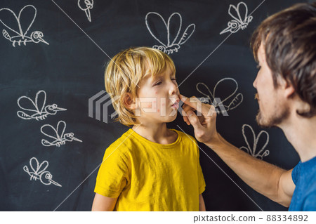 The boy is bitten by mosquitoes on a dark background. Dad smears his bite ointment. On the blackboard with chalk painted mosquitoes 88334892