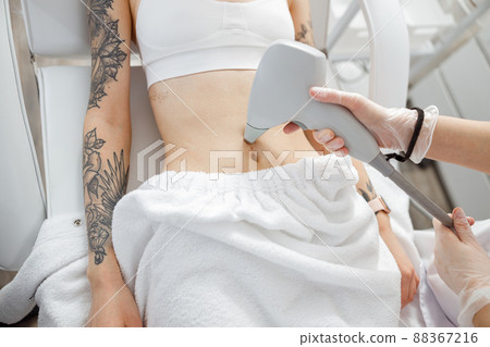 Young woman receiving abdominal laser treatment in beauty clinic Young woman receiving abdominal laser treatment in beauty clinic 88367216