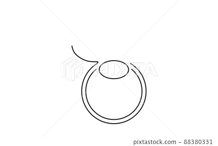 LASIK, Medical Illustration of Refractive Surgery 88380331