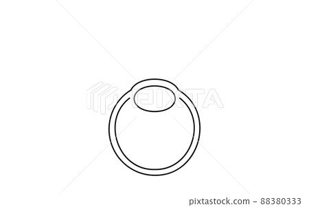LASIK,屈光手術的醫學插圖 LASIK,屈光手術的醫學插圖 88380333