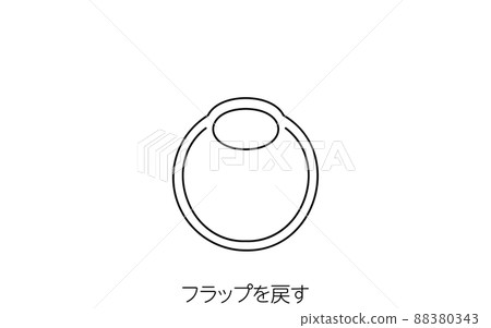 LASIK, Medical Illustration of Refractive Surgery 88380343