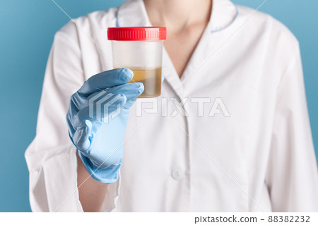 doctor in a white uniform and blue gloves on blue background holds plastic test jar with yellow urine. test for disease 88382232