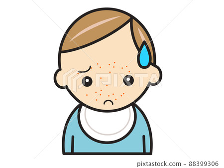 Baby with eczema on face - Stock Illustration [88399306] - PIXTA