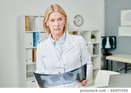 Serious mature female doctor with x-ray image of patient lungs looking at you 88405998