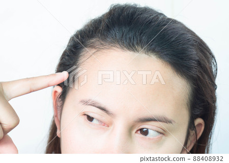 Woman serious hair loss problem for health care shampoo and beauty product concept, selective focus 88408932
