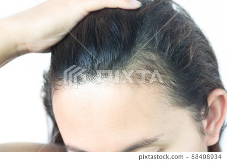 Woman serious hair loss problem for health care shampoo and beauty product concept, selective focus 88408934